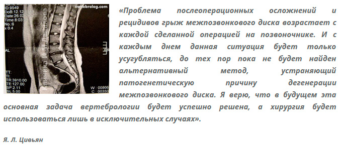 Мр картина дегенеративно дистрофических изменений пояснично крестцового отдела позвоночника и армия