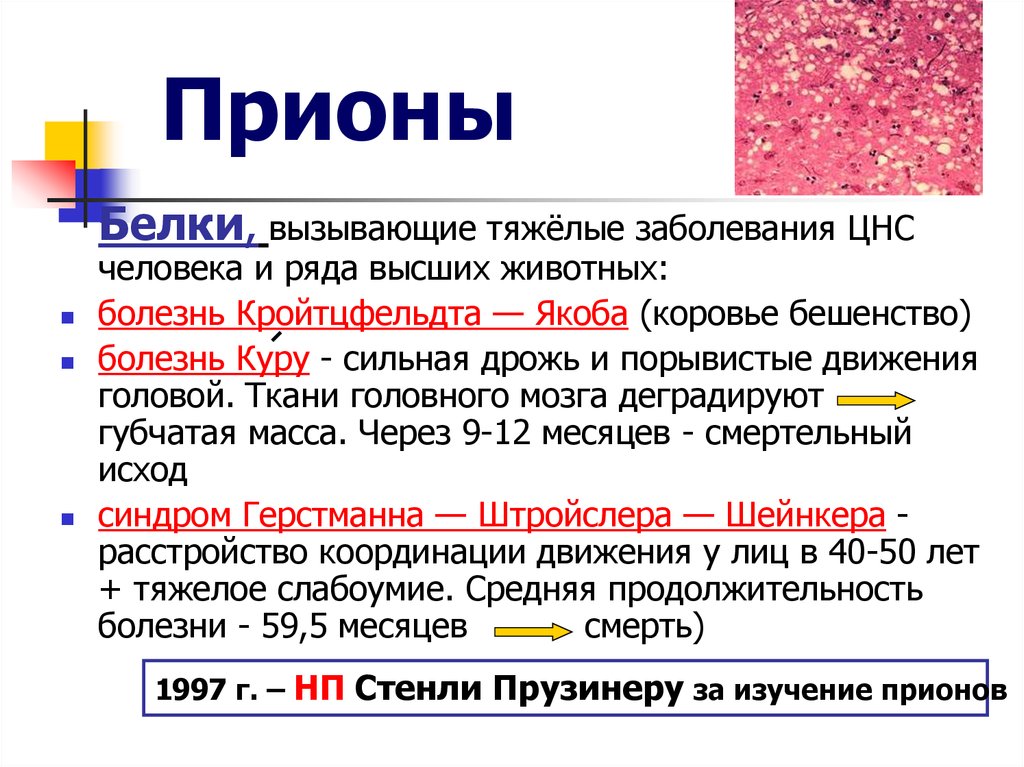 Прионная болезнь что это. Белки прионы болезни. Заболевания человека, вызываемые прионами. Прионы вызывают заболевания. Прионы микробиология.