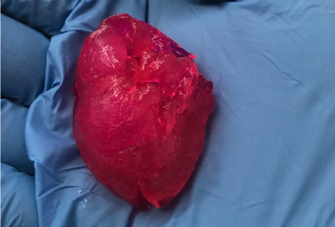 Чикагская биокомпания сумела напечатать человеческое мини-сердце.