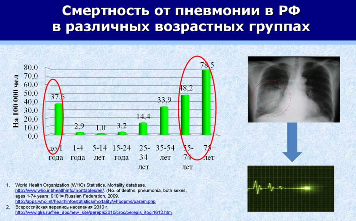 От пневмонии умирают. Смертность от пневмонии. Статистика смертности от пневмонии в 2019. Статистика смертей от пневмонии по годам. Статистика смертей от пневмонии.